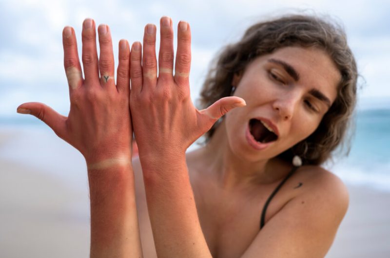 Cilt Tipinize Uygun Güneş Kremini Nasıl Seçersiniz?