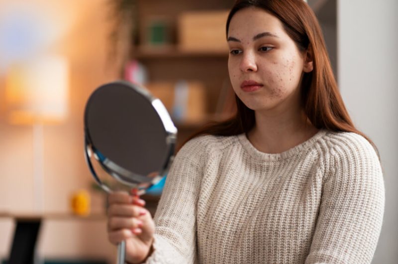 Derhal Bir Dermatoloğa Görünmeniz Gerektiğini Gösteren 5 Kritik İşaret: