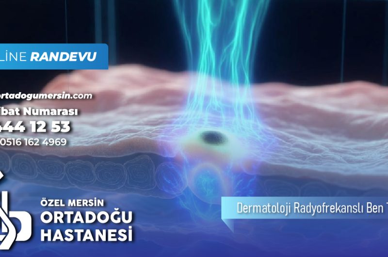 Dermatolojide Lazerle Ben Tedavisi Hakkında Bilinmesi Gerekenler