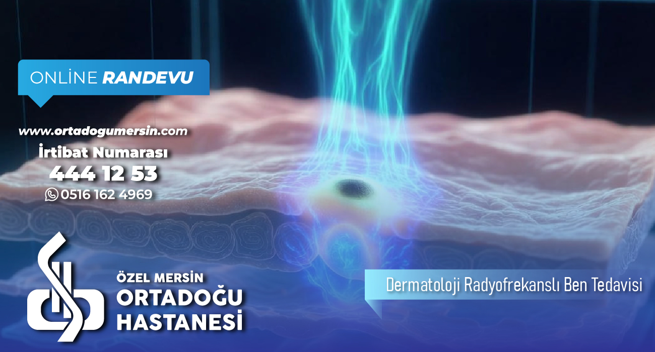 Dermatolojide Lazerle Ben Tedavisi Hakkında Bilinmesi Gerekenler