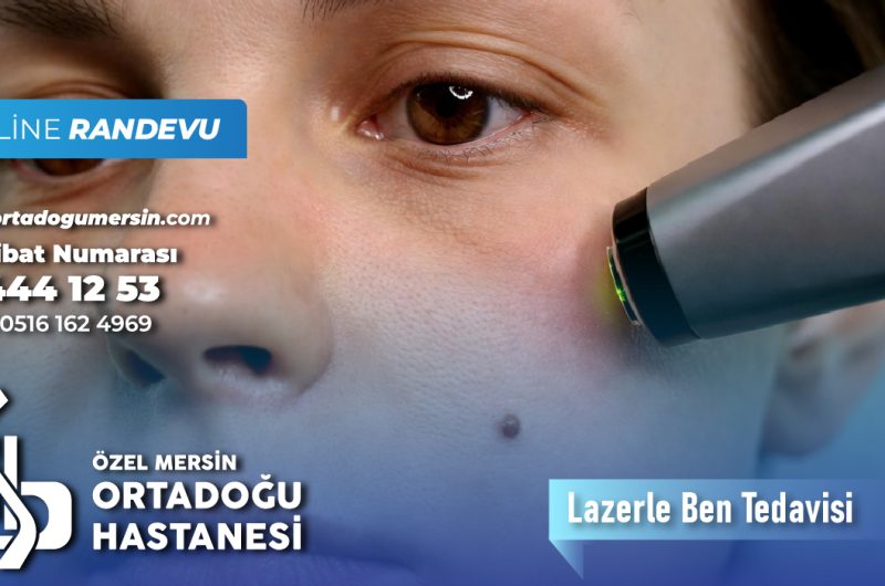 Lazerle Ben Tedavisi Nedir? Nasıl Uygulanır? Kimler İçin Uygundur?