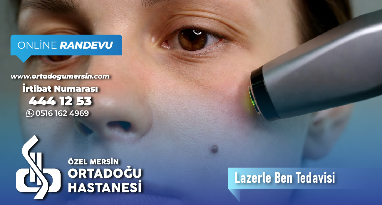 Lazerle Ben Tedavisi Nedir? Nasıl Uygulanır? Kimler İçin Uygundur?