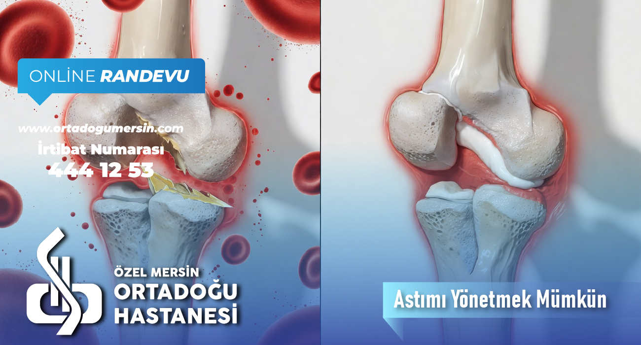 Kırık Kemik İyileşme Süreci Nasıldır? Ne Kadar Sürer?