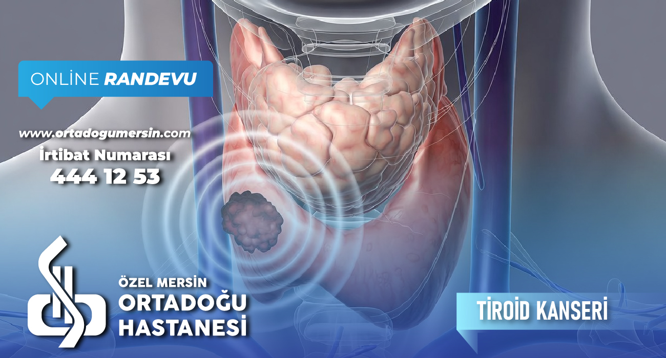 Tiroid Kanseri Nedir? Belirtileri, Tanısı ve Tedavi Yöntemleri