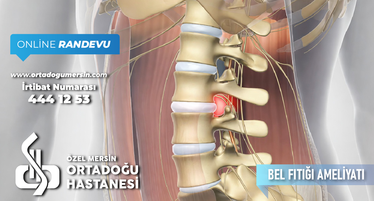 Bel Fıtığı Ameliyatı: Bilmeniz Gereken Her Şey