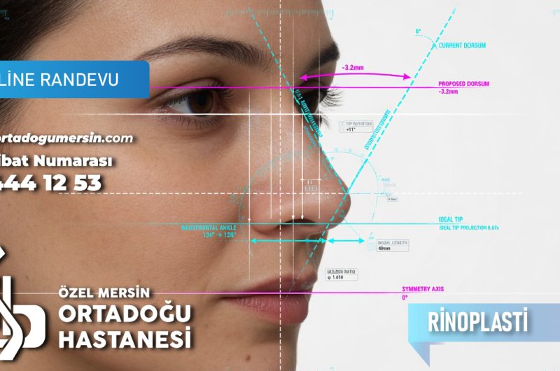 🩺 Rinoplasti (Burun Estetiği) Nedir? Süreç Nasıl İlerler?